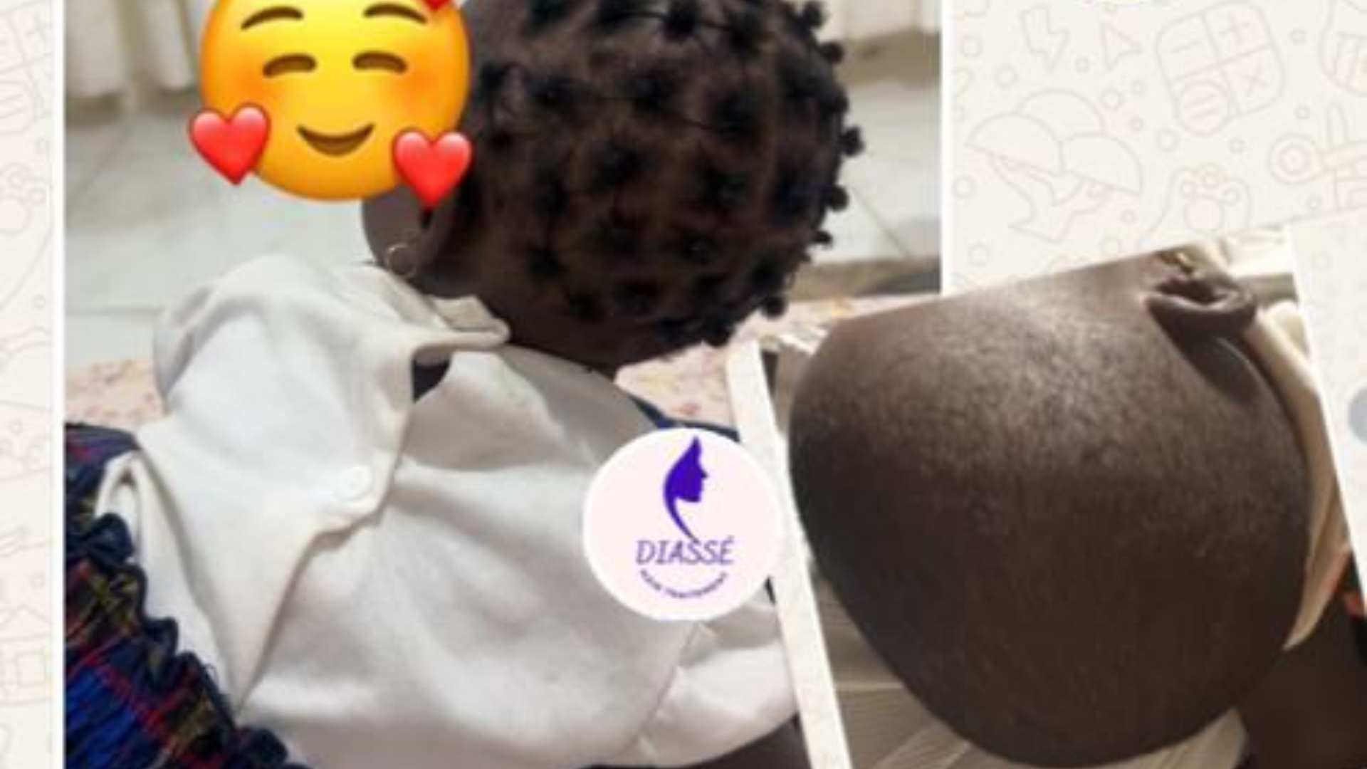 temoignage serum kid